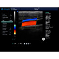 máquina do ecocardiograma de Doppler da cor &amp; ultra-som doppler da cor